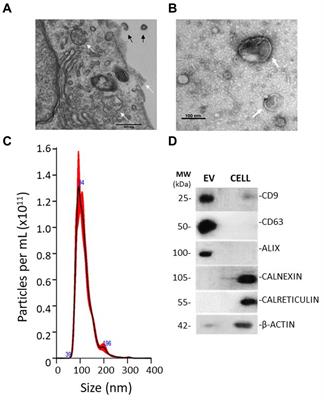 MicroRNA profile of extracellular vesicles released by Müller glial cells